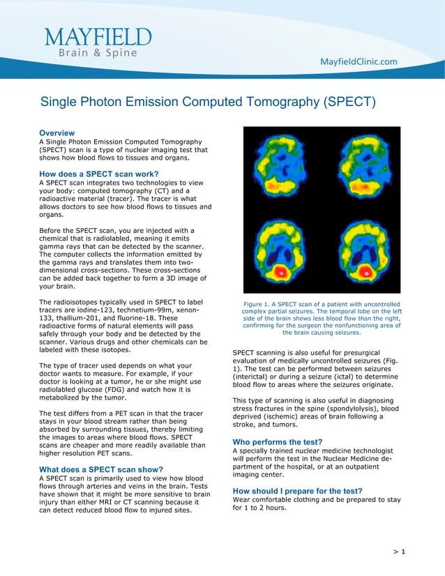 SPECT Scan PDF