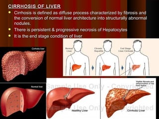 CIRRHOSIS OF LIVERCIRRHOSIS OF LIVER
 Cirrhosis is defined as diffuse process characterized by fibrosis andCirrhosis is defined as diffuse process characterized by fibrosis and
the conversion of normal liver architecture into structurally abnormalthe conversion of normal liver architecture into structurally abnormal
nodules.nodules.
 There is persistent & progressive necrosis of HepatocytesThere is persistent & progressive necrosis of Hepatocytes
 It is the end stage condition of liverIt is the end stage condition of liver
11
 