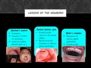 Surgical Procedures in Pediatric Dentistry: Enhancing Oral Health