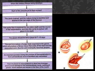 minor oral surgical procedures in pediatric dentistry | PPTX