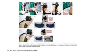 Lee et al., Wolrd J Gastroenterol 2014;20(45): 16984-95
 