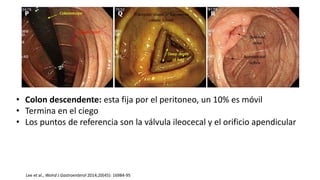 Lee et al., Wolrd J Gastroenterol 2014;20(45): 16984-95
• Colon descendente: esta fija por el peritoneo, un 10% es móvil
• Termina en el ciego
• Los puntos de referencia son la válvula ileocecal y el orificio apendicular
 