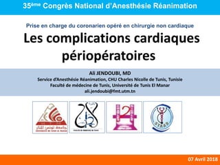 Perioperative Cardiac Complications. Ali JENDOUBI, MD. 2018