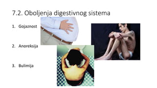 7.2. Oboljenja digestivnog sistema
1. Gojaznost
2. Anoreksija
3. Bulimija
 