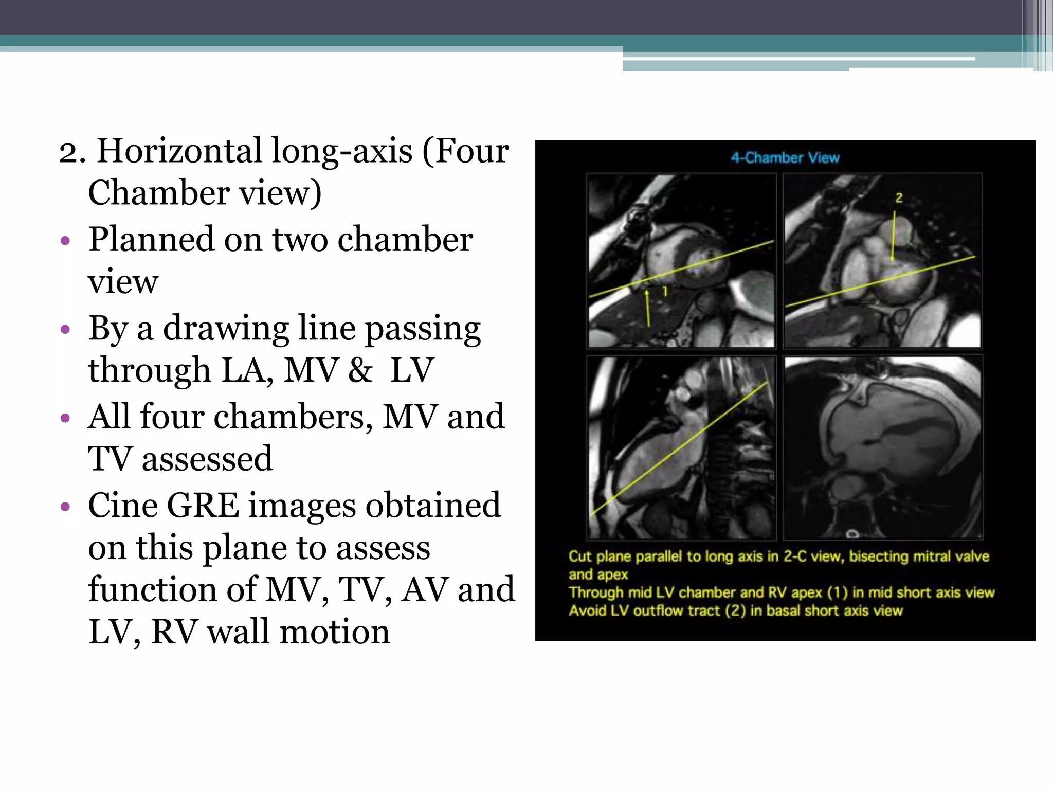 Cardiac Magnetic Resonance Imaging | PPTX