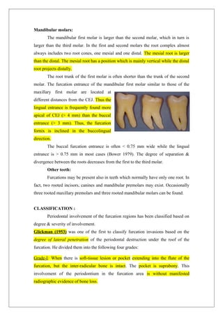 Mandibular molars:
The mandibular first molar is larger than the second molar, which in turn is
larger than the third molar. In the first and second molars the root complex almost
always includes two root cones, one mesial and one distal. The mesial root is larger
than the distal. The mesial root has a position which is mainly vertical while the distal
root projects distally.
The root trunk of the first molar is often shorter than the trunk of the second
molar. The furcation entrance of the mandibular first molar similar to those of the
maxillary first molar are located at
different distances from the CEJ. Thus the
lingual entrance is frequently found more
apical of CEJ (> 4 mm) than the buccal
entrance (> 3 mm). Thus, the furcation
fornix is inclined in the buccolingual
direction.
The buccal furcation entrance is often < 0.75 mm wide while the lingual
entrance is > 0.75 mm in most cases (Bower 1979). The degree of separation &
divergence between the roots decreases from the first to the third molar.
Other teeth:
Furcations may be present also in teeth which normally have only one root. In
fact, two rooted incisors, canines and mandibular premolars may exist. Occasionally
three rooted maxillary premolars and three rooted mandibular molars can be found.
CLASSIFICATION :
Periodontal involvement of the furcation regions has been classified based on
degree & severity of involvement.
Glickman (1953) was one of the first to classify furcation invasions based on the
degree of lateral penetration of the periodontal destruction under the roof of the
furcation. He divided them into the following four grades:
Grade-I: When there is soft-tissue lesion or pocket extending into the flute of the
furcation, but the inter-radicular bone is intact. The pocket is suprabony. This
involvement of the periodontium in the furcation area is without manifested
radiographic evidence of bone loss.
 
