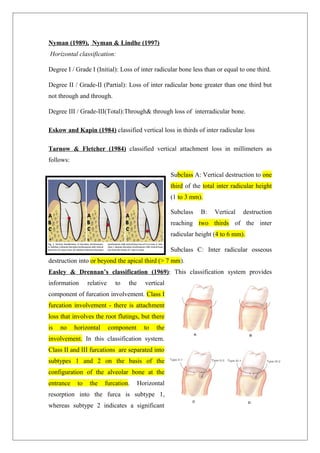 Nyman (1989), Nyman & Lindhe (1997)
Horizontal classification:
Degree I / Grade I (Initial): Loss of inter radicular bone less than or equal to one third.
Degree II / Grade-II (Partial): Loss of inter radicular bone greater than one third but
not through and through.
Degree III / Grade-III(Total):Through& through loss of interradicular bone.
Eskow and Kapin (1984) classified vertical loss in thirds of inter radicular loss
Tarnow & Fletcher (1984) classified vertical attachment loss in millimeters as
follows:
Subclass A: Vertical destruction to one
third of the total inter radicular height
(1 to 3 mm).
Subclass B: Vertical destruction
reaching two thirds of the inter
radicular height (4 to 6 mm).
Subclass C: Inter radicular osseous
destruction into or beyond the apical third (> 7 mm).
Easley & Drennan’s classification (1969): This classification system provides
information relative to the vertical
component of furcation involvement. Class I
furcation involvement - there is attachment
loss that involves the root flutings, but there
is no horizontal component to the
involvement. In this classification system.
Class II and III furcations are separated into
subtypes 1 and 2 on the basis of the
configuration of the alveolar bone at the
entrance to the furcation. Horizontal
resorption into the furca is subtype 1,
whereas subtype 2 indicates a significant
 