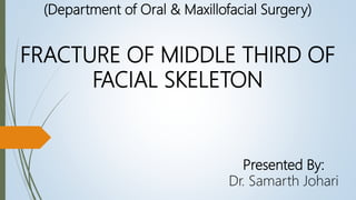 (Department of Oral & Maxillofacial Surgery)
FRACTURE OF MIDDLE THIRD OF
FACIAL SKELETON
Presented By:
Dr. Samarth Johari
 