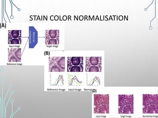 STAIN COLOR NORMALISATION
 