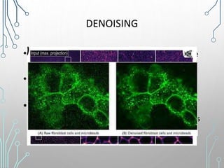 DENOISING
• Another contribution of AI that can markedly improve
image quality is reduction of noise.
• Images with low signals can be difficult to interpret
esp. in vivo imaging challenging
• U-net architecture was successfully utilized for
image denoising of fluorescent microscopy images
 