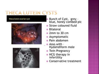 theca luteum cyst
