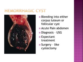  Bleeding into either
corpus luteum or
follicular cyst
 Acute Pain abdomen
 Diagnosis – USG
 Expectant
treatment
 Surgery – like
cystectomy
 