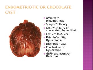  Asso. with
endometriosis
 Sampon’s theory
 Cyst with tarry or
chocolate coloured fluid
 Few cm to 20 cm
 Pain, Infertility,
Dyspareunia
 Diagnosis - USG
 Enucleation or
Cystectomy
 GnRH analogues or
Danazole
 