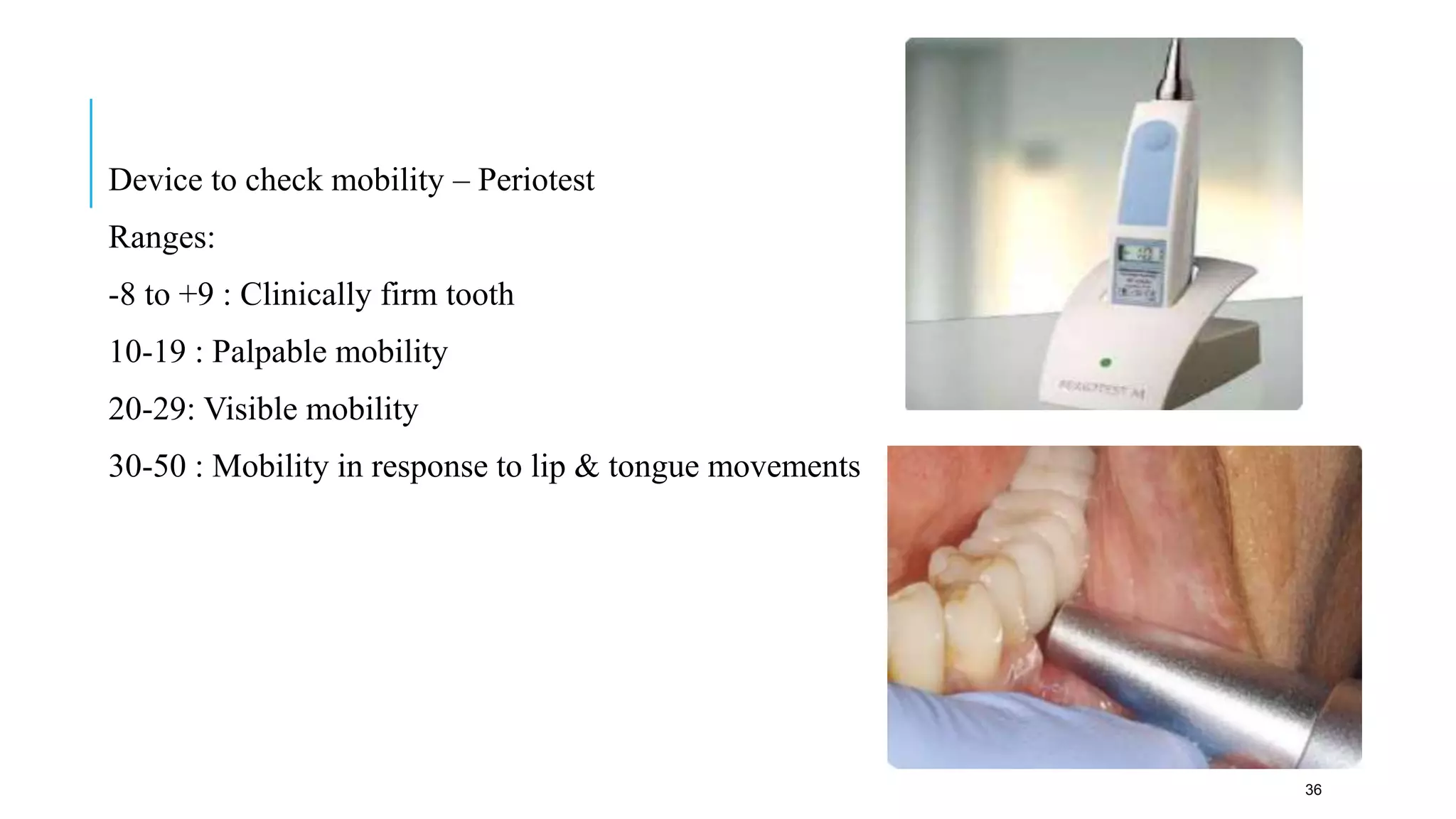 Chronic periodontitis | PPTX