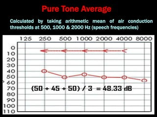 7. Audiometry Dr. Krishna Koirala | PPT