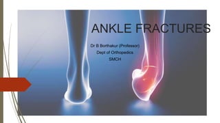 ANKLE FRACTURES
Dr B Borthakur (Professor)
Dept of Orthopedics
SMCH
 