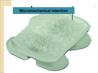 Micromechanical retention
 