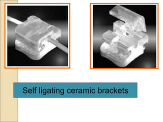 Self ligating ceramic brackets
 