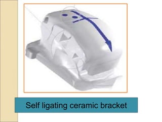 Self ligating ceramic bracket
 