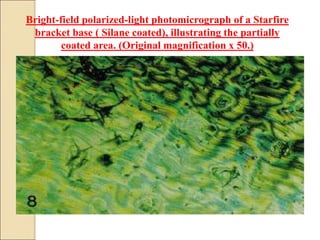 Bright-field polarized-light photomicrograph of a Starfire
bracket base ( Silane coated), illustrating the partially
coated area. (Original magnification x 50.)
 