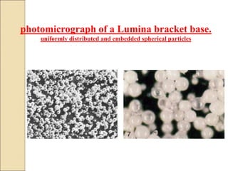 photomicrograph of a Lumina bracket base.
uniformly distributed and embedded spherical particles
 