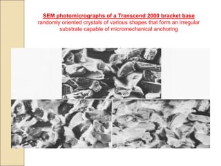 SEM photomicrographs of a Transcend 2000 bracket base
randomly oriented crystals of various shapes that form an irregular
substrate capable of micromechanical anchoring
 