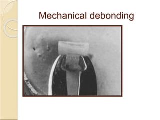 Mechanical debonding
 