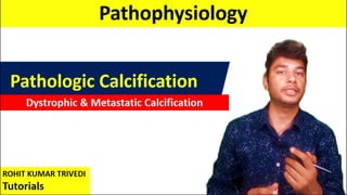 Dystrophic & Metastatic Calcification
Pathologic Calcification
Pathophysiology
ROHIT KUMAR TRIVEDI
Tutorials
 