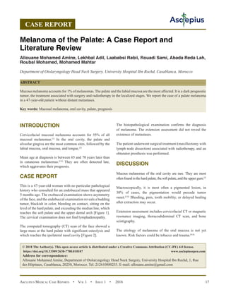Asclepius Medical Case Reports  •  Vol 1  • Issue 1  •  2018 17
INTRODUCTION
Cervicofacial mucosal melanoma accounts for 55% of all
mucosal melanomas.[1]
In the oral cavity, the palate and
alveolar gingiva are the most common sites, followed by the
labial mucosa, oral mucosa, and tongue.[2]
Mean age at diagnosis is between 65 and 70 years later than
in cutaneous melanomas.[3,4]
They are often detected late,
which aggravates their prognosis.
CASE REPORT
This is a 47-year-old woman with no particular pathological
history who consulted for an endobuccal mass that appeared
5 months ago. The exobuccal examination shows asymmetry
of the face, and the endobuccal examination reveals a budding
tumor, blackish in color, bleeding on contact, sitting on the
level of the hard palate, and exceeding the median line, which
reaches the soft palate and the upper dental arch [Figure 1].
The cervical examination does not find lymphadenopathy.
The computed tomography (CT) scan of the face showed a
large mass at the hard palate with significant osteolysis and
which reaches the ipsilateral nasal cavity [Figure 2].
The histopathological examination confirms the diagnosis
of melanoma. The extension assessment did not reveal the
existence of metastases.
The patient underwent surgical treatment (maxillectomy with
lymph node dissection) associated with radiotherapy, and an
obturator prosthesis was performed.
DISCUSSION
Mucous melanomas of the oral cavity are rare. They are most
often found in the hard palate, the soft palate, and the upper gum.[1]
Macroscopically, it is most often a pigmented lesion, in
30% of cases, the pigmentation would precede tumor
onset.[5,6]
Bleeding, pain, tooth mobility, or delayed healing
after extraction may occur.
Extension assessment includes cervicofacial CT or magnetic
resonance imaging, thoracoabdominal CT scan, and bone
scintigraphy.
The etiology of melanoma of the oral mucosa is not yet
known. Risk factors could be tobacco and trauma.[4,6]
Melanoma of the Palate: A Case Report and
Literature Review
Allouane Mohamed Amine, Lekhbal Adil, Laababsi Rabii, Rouadi Sami, Abada Reda Lah,
Roubal Mohamed, Mohamed Mahtar
Department of Otolaryngology Head Neck Surgery, University Hospital Ibn Rochd, Casablanca, Morocco
ABSTRACT
Mucous melanoma accounts for 1% of melanomas. The palate and the labial mucosa are the most affected. It is a dark prognostic
tumor, the treatment associated with surgery and radiotherapy in the localized stages. We report the case of a palate melanoma
in a 47-year-old patient without distant metastases.
Key words: Mucosal melanoma, oral cavity, palate, prognosis
© 2018 The Author(s). This open access article is distributed under a Creative Commons Attribution (CC-BY) 4.0 license.
https://doi.org/10.33309/2638-7700.010107 www.asclepiusopen.com
Address for correspondence:
Allouane Mohamed Amine, Department of Otolaryngology Head Neck Surgery, University Hospital Ibn Rochd, 1, Rue
des Hôpitaux, Casablanca, 20250, Morocco. Tel: 212610880235. E-mail: allouane.amine@gmail.com
CASE REPORT
 