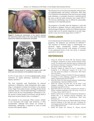 Melanoma of the Palate: A Case Report and Literature Review | PDF