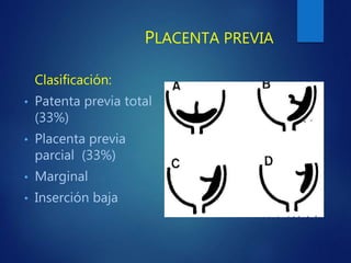 PLACENTA PREVIA
Clasificación:
• Patenta previa total
(33%)
• Placenta previa
parcial (33%)
• Marginal
• Inserción baja
 