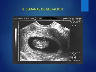 8 SEMANAS DE GESTACION
 