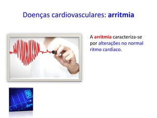 Doenças cardiovasculares: arritmia
A arritmia caracteriza-se
por alterações no normal
ritmo cardíaco.
 