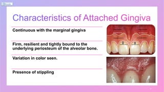 Attached Gingiva.pptx