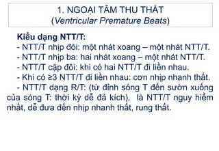 1. NGOẠI TÂM THU THẤT
(Ventricular Premature Beats)
Kiểu dạng NTT/T:
- NTT/T nhịp đôi: một nhát xoang – một nhát NTT/T.
- NTT/T nhịp ba: hai nhát xoang – một nhát NTT/T.
- NTT/T cặp đôi: khi có hai NTT/T đi liền nhau.
- Khi có ≥3 NTT/T đi liền nhau: cơn nhịp nhanh thất.
- NTT/T dạng R/T: (từ đỉnh sóng T đến sườn xuống
của sóng T: thời kỳ dễ đả kích), là NTT/T nguy hiểm
nhất, dễ đưa đến nhịp nhanh thất, rung thất.
 