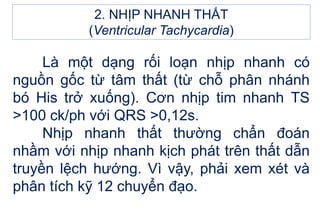 2. NHỊP NHANH THẤT
(Ventricular Tachycardia)
Là một dạng rối loạn nhịp nhanh có
nguồn gốc từ tâm thất (từ chỗ phân nhánh
bó His trở xuống). Cơn nhịp tim nhanh TS
>100 ck/ph với QRS >0,12s.
Nhịp nhanh thất thường chẩn đoán
nhầm với nhịp nhanh kịch phát trên thất dẫn
truyền lệch hướng. Vì vậy, phải xem xét và
phân tích kỹ 12 chuyển đạo.
 