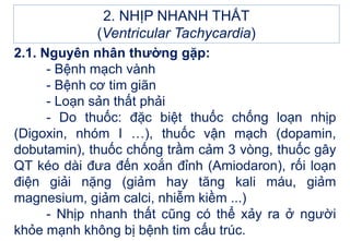 2.1. Nguyên nhân thường gặp:
- Bệnh mạch vành
- Bệnh cơ tim giãn
- Loạn sản thất phải
- Do thuốc: đặc biệt thuốc chống loạn nhịp
(Digoxin, nhóm I …), thuốc vận mạch (dopamin,
dobutamin), thuốc chống trầm cảm 3 vòng, thuốc gây
QT kéo dài đưa đến xoắn đỉnh (Amiodaron), rối loạn
điện giải nặng (giảm hay tăng kali máu, giảm
magnesium, giảm calci, nhiễm kiềm ...)
- Nhịp nhanh thất cũng có thể xảy ra ở người
khỏe mạnh không bị bệnh tim cấu trúc.
2. NHỊP NHANH THẤT
(Ventricular Tachycardia)
 
