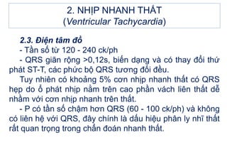 2. NHỊP NHANH THẤT
(Ventricular Tachycardia)
2.3. Điện tâm đồ
- Tần số từ 120 - 240 ck/ph
- QRS giãn rộng >0,12s, biến dạng và có thay đổi thứ
phát ST-T, các phức bộ QRS tương đối đều.
Tuy nhiên có khoảng 5% cơn nhịp nhanh thất có QRS
hẹp do ổ phát nhịp nằm trên cao phần vách liên thất dễ
nhầm với cơn nhịp nhanh trên thất.
- P có tần số chậm hơn QRS (60 - 100 ck/ph) và không
có liên hệ với QRS, đây chính là dấu hiệu phân ly nhĩ thất
rất quan trọng trong chẩn đoán nhanh thất.
 