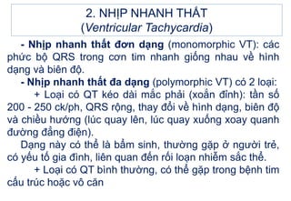 2. NHỊP NHANH THẤT
(Ventricular Tachycardia)
- Nhịp nhanh thất đơn dạng (monomorphic VT): các
phức bộ QRS trong cơn tim nhanh giống nhau về hình
dạng và biên độ.
- Nhịp nhanh thất đa dạng (polymorphic VT) có 2 loại:
+ Loại có QT kéo dài mắc phải (xoắn đỉnh): tần số
200 - 250 ck/ph, QRS rộng, thay đổi về hình dạng, biên độ
và chiều hướng (lúc quay lên, lúc quay xuống xoay quanh
đường đẳng điện).
Dạng này có thể là bẩm sinh, thường gặp ở người trẻ,
có yếu tố gia đình, liên quan đến rối loạn nhiễm sắc thể.
+ Loại có QT bình thường, có thể gặp trong bệnh tim
cấu trúc hoặc vô căn
 