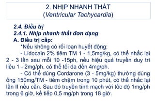 2. NHỊP NHANH THẤT
(Ventricular Tachycardia)
2.4. Điều trị
2.4.1. Nhịp nhanh thất đơn dạng
A. Điều trị cấp:
*Nếu không có rối loạn huyết động:
- Lidocain 2% tiêm TM 1 - 1,5mg/kg, có thể nhắc lại
2 - 3 lần sau mỗi 10 -15ph, nếu hiệu quả truyền duy trì
liều 1 - 2mg/ph, có thể tối đa đến 4mg/ph.
- Có thể dùng Cordarone (3 - 5mg/kg) thường dùng
ống 150mg/TM - tiêm chậm trong 10 phút, có thể nhắc lại
lần II nếu cần. Sau đó truyền tĩnh mạch với tốc độ 1mg/ph
trong 6 giờ, kế tiếp 0,5 mg/ph trong 18 giờ.
 