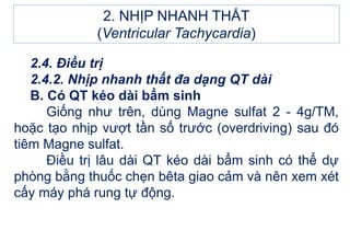 2.4. Điều trị
2.4.2. Nhịp nhanh thất đa dạng QT dài
B. Có QT kéo dài bẩm sinh
Giống như trên, dùng Magne sulfat 2 - 4g/TM,
hoặc tạo nhịp vượt tần số trước (overdriving) sau đó
tiêm Magne sulfat.
Điều trị lâu dài QT kéo dài bẩm sinh có thể dự
phòng bằng thuốc chẹn bêta giao cảm và nên xem xét
cấy máy phá rung tự động.
2. NHỊP NHANH THẤT
(Ventricular Tachycardia)
 