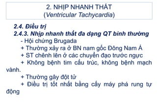 2.4. Điều trị
2.4.3. Nhịp nhanh thất đa dạng QT bình thường
- Hội chứng Brugada
+ Thường xảy ra ở BN nam gốc Đông Nam Á
+ ST chênh lên ở các chuyển đạo trước ngực
+ Không bệnh tim cấu trúc, không bệnh mạch
vành.
+ Thường gây đột tử
+ Điều trị tốt nhất bằng cấy máy phá rung tự
động
2. NHỊP NHANH THẤT
(Ventricular Tachycardia)
 