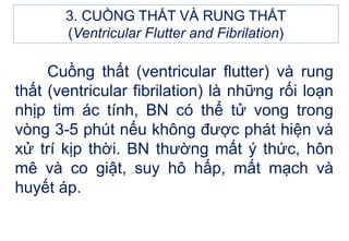 3. CUỒNG THẤT VÀ RUNG THẤT
(Ventricular Flutter and Fibrilation)
Cuồng thất (ventricular flutter) và rung
thất (ventricular fibrilation) là những rối loạn
nhịp tim ác tính, BN có thể tử vong trong
vòng 3-5 phút nếu không được phát hiện và
xử trí kịp thời. BN thường mất ý thức, hôn
mê và co giật, suy hô hấp, mất mạch và
huyết áp.
 