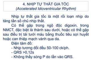 4. NHỊP TỰ THẤT GIA TỐC
(Accelerated Idioventricular Rhythm)
Nhịp tự thất gia tốc là một rối loạn nhịp do
tăng tần số chủ nhịp thất.
Có thể gặp trong ngộ độc digoxin, trong
NMCT, đặc biệt là thành sau dưới, hoặc có thể gặp
sau điều trị tái tưới máu bằng thuốc tiêu sợi huyết
hoặc can thiệp mạch vành qua da.
Điện tâm đồ:
- Nhịp tương đối đều 50-100 ck/ph.
- QRS >0,12s
- Không thấy sóng P do lẫn vào QRS.
 