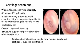 Cartilage technique.
Why cartilage use in tympanoplasty
-If ongoing ET dysfunction
-If ossiculoplasty is done-to avoid
extrusion risk and to augment prosthesis-
tissue interface for good hearing results.
-Atelectatic ear
-Second stage ossiculoplasty
-Structural support for posterior superior
retraction pockets
Fascia and perichondrium need a new vascular supply but
cartilage is supplied by diffusion
 