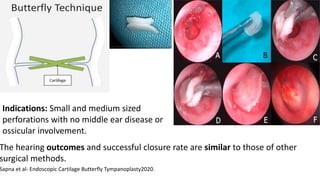 Indications: Small and medium sized
perforations with no middle ear disease or
ossicular involvement.
Sapna et al- Endoscopic Cartilage Butterfly Tympanoplasty2020.
The hearing outcomes and successful closure rate are similar to those of other
surgical methods.
 
