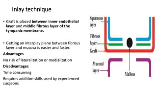 Inlay technique
• Graft is placed between inner endothelial
layer and middle fibrous layer of the
tympanic membrane.
• Getting an interplay plane between fibrous
layer and mucosa is easier and faster.
Advantages
No risk of lateralization or medialization
Disadvantages
Time consuming
Requires addition skills used by experienced
surgeons
 