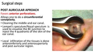 Surgical steps
POST AURICULAR APROACH
Favors anterior perforations.
Allows one to do a circumferential
canalplasty.
• Cleaning the middle and ear canal.
• Lempet's speculum/Nasal speculum is
used to visualize the BC junction to
inject the 4 quadrants of the skin of the
ear canal.
• Local infiltration of the tissues is done
anteroinferiorly and anterosuperiorly
and post auricular region.
 