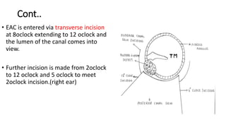 Cont..
• EAC is entered via transverse incision
at 8oclock extending to 12 oclock and
the lumen of the canal comes into
view.
• Further incision is made from 2oclock
to 12 oclock and 5 oclock to meet
2oclock incision.(right ear)
 