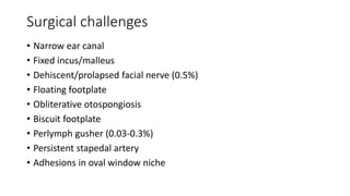 Surgical challenges
• Narrow ear canal
• Fixed incus/malleus
• Dehiscent/prolapsed facial nerve (0.5%)
• Floating footplate
• Obliterative otospongiosis
• Biscuit footplate
• Perlymph gusher (0.03-0.3%)
• Persistent stapedal artery
• Adhesions in oval window niche
 